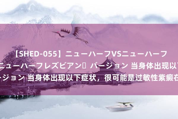 【SHED-055】ニューハーフVSニューハーフ 不純同性肛遊 2 魅惑のニューハーフレズビアン・バージョン 当身体出现以下症状，很可能是过敏性紫癜在捣蛋！